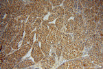 PSMA7 Antibody in Immunohistochemistry (Paraffin) (IHC (P))