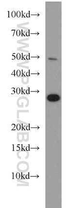 PSMA7 Antibody in Western Blot (WB)