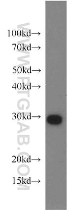 PSMA7 Antibody in Western Blot (WB)