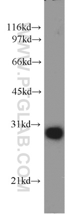 PSMA7 Antibody in Western Blot (WB)