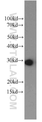 PSMA7 Antibody in Western Blot (WB)