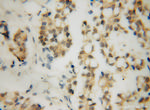 RPAIN Antibody in Immunohistochemistry (Paraffin) (IHC (P))