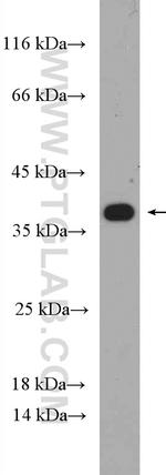 RPAIN Antibody in Western Blot (WB)