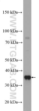 RPAIN Antibody in Western Blot (WB)