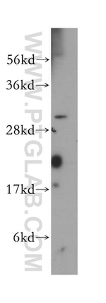 RPAIN Antibody in Western Blot (WB)