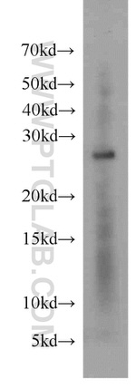 YWHAH Antibody in Western Blot (WB)