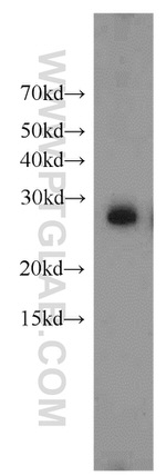 YWHAH Antibody in Western Blot (WB)