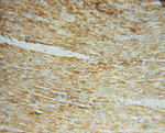 NDUFS5 Antibody in Immunohistochemistry (Paraffin) (IHC (P))