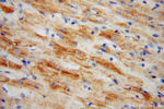 NDUFS5 Antibody in Immunohistochemistry (Paraffin) (IHC (P))