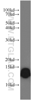 NDUFS5 Antibody in Western Blot (WB)