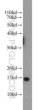 NDUFS5 Antibody in Western Blot (WB)