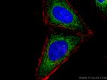 SLC25A1 Antibody in Immunocytochemistry (ICC/IF)