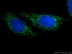 SLC25A1 Antibody in Immunocytochemistry (ICC/IF)