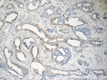 SLC25A1 Antibody in Immunohistochemistry (Paraffin) (IHC (P))