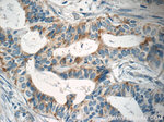 SLC25A1 Antibody in Immunohistochemistry (Paraffin) (IHC (P))