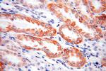 SLC25A1 Antibody in Immunohistochemistry (Paraffin) (IHC (P))