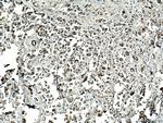 SLC25A1 Antibody in Immunohistochemistry (Paraffin) (IHC (P))