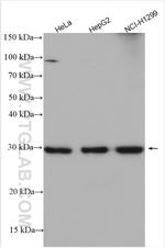 SLC25A1 Antibody in Western Blot (WB)