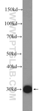 SLC25A1 Antibody in Western Blot (WB)