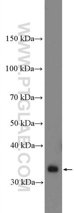 SLC25A1 Antibody in Western Blot (WB)