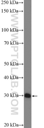 SLC25A1 Antibody in Western Blot (WB)