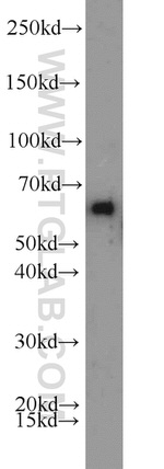 ACP2 Antibody in Western Blot (WB)