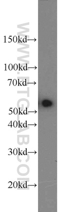 ACP2 Antibody in Western Blot (WB)