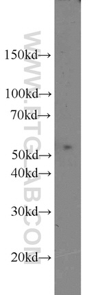 ACP2 Antibody in Western Blot (WB)