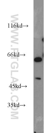 ACP2 Antibody in Western Blot (WB)