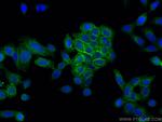 HLA class I ABC Antibody in Immunocytochemistry (ICC/IF)