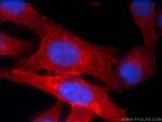 HLA class I ABC Antibody in Immunocytochemistry (ICC/IF)