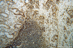 HLA class I ABC Antibody in Immunohistochemistry (Paraffin) (IHC (P))