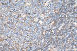 HLA class I ABC Antibody in Immunohistochemistry (Paraffin) (IHC (P))