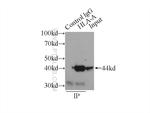 HLA class I ABC Antibody in Immunoprecipitation (IP)