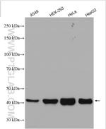 HLA class I ABC Antibody in Western Blot (WB)