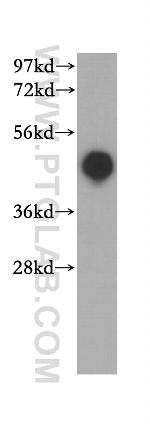 HLA class I ABC Antibody in Western Blot (WB)