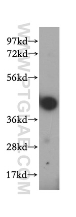 HLA class I ABC Antibody in Western Blot (WB)