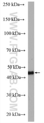 HLA class I ABC Antibody in Western Blot (WB)