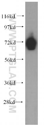 PCDHB5 Antibody in Western Blot (WB)