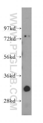 GEMIN8 Antibody in Western Blot (WB)