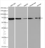 MAGED2 Antibody in Western Blot (WB)