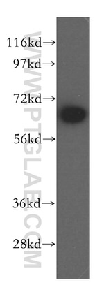 MAGED2 Antibody in Western Blot (WB)