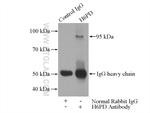 H6PD Antibody in Immunoprecipitation (IP)