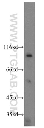 H6PD Antibody in Western Blot (WB)