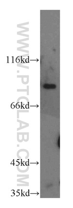 H6PD Antibody in Western Blot (WB)