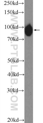 H6PD Antibody in Western Blot (WB)