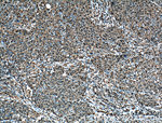 PSMD13 Antibody in Immunohistochemistry (Paraffin) (IHC (P))