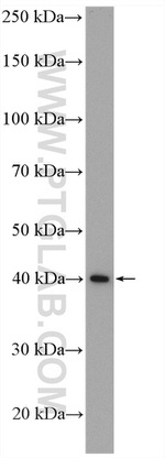 PSMD13 Antibody in Western Blot (WB)