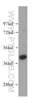 TMOD2 Antibody in Western Blot (WB)