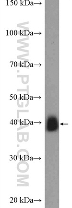 TMOD2 Antibody in Western Blot (WB)